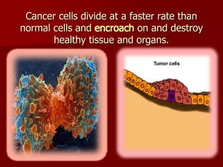 Cancer cells divide at a faster rate than
normal cells and encroach on and destroy
healthy tissue and organs.
 