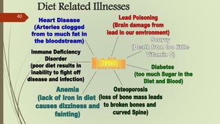 40
Diet Related Illnesses
 