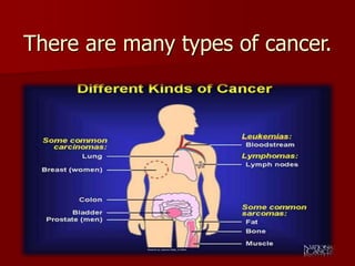 There are many types of cancer.
 