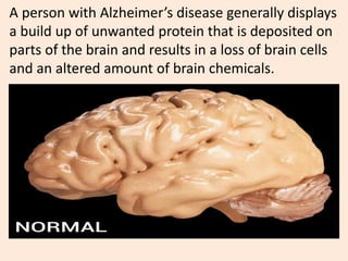 A person with Alzheimer’s disease generally displays
a build up of unwanted protein that is deposited on
parts of the brain and results in a loss of brain cells
and an altered amount of brain chemicals.
 