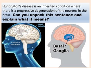 Huntington’s disease is an inherited condition where
there is a progressive degeneration of the neurons in the
brain. Can you unpack this sentence and
explain what it means?
 