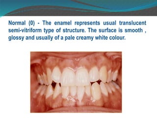 Enamel Normal Map Deans F index and who o h a form - dr. Vaibhav (2).pptx