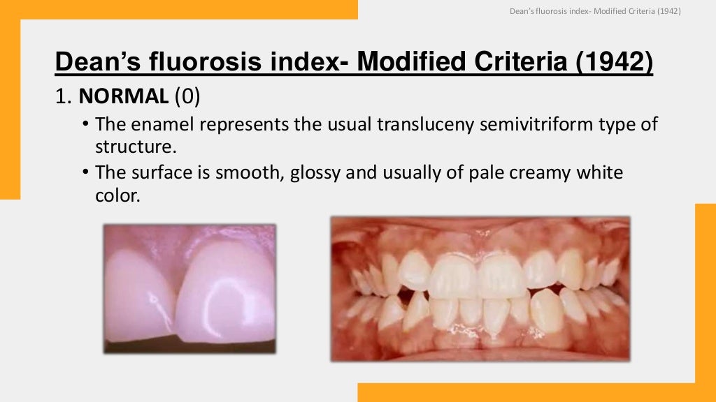 DEAN’S FLUOROSIS INDEX 1943 (PUBLIC HEALTH DENTISTRY)