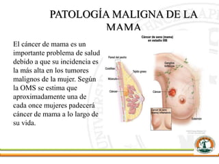 PATOLOGÍA MALIGNA DE LA
MAMA
El cáncer de mama es un
importante problema de salud
debido a que su incidencia es
la más alta en los tumores
malignos de la mujer. Según
la OMS se estima que
aproximadamente una de
cada once mujeres padecerá
cáncer de mama a lo largo de
su vida.
 