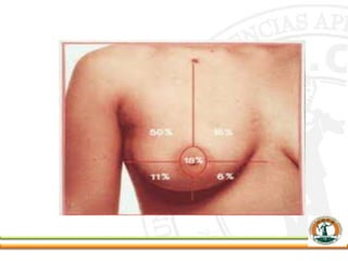 MAMA Y CÁNCER DE MAMA.