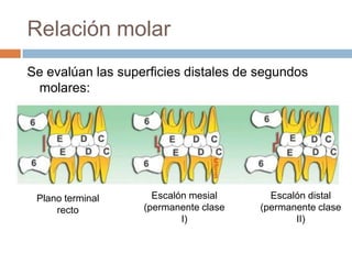 Relación molar
Escalón distal
(permanente clase
II)
Se evalúan las superficies distales de segundos
molares:
Escalón mesial
(permanente clase
I)
Plano terminal
recto
 