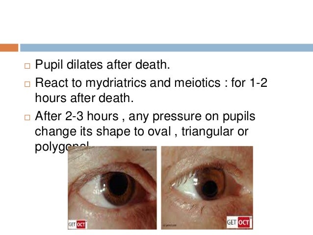 25 Ef 82 A8 Pupil Dilates After 25 Ef 82 A8 Pupil Dilates After
