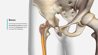 Bones
Chronic lack of movement leads to
decreased bone density, paving the
way towards osteoporosis, and an
increased risk of fractures.
 