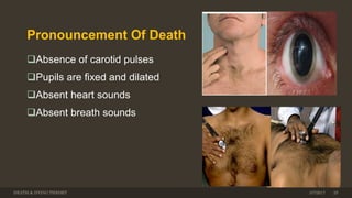 Pronouncement Of Death
Absence of carotid pulses
Pupils are fixed and dilated
Absent heart sounds
Absent breath sounds
DEATH & DYING THEORY 3/7/2017 25
 