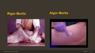 Rigor Mortis Algor Mortis
DEATH & DYING THEORY 303/7/2017
 