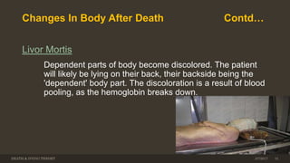 Changes In Body After Death Contd…
Livor Mortis
Dependent parts of body become discolored. The patient
will likely be lying on their back, their backside being the
'dependent' body part. The discoloration is a result of blood
pooling, as the hemoglobin breaks down.
DEATH & DYING THEORY 313/7/2017
 