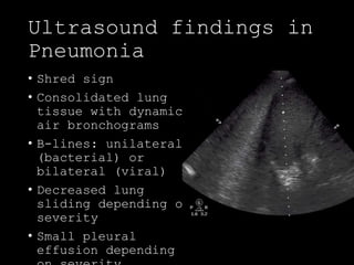 POCUS assessment of Dyspnea | PPTX