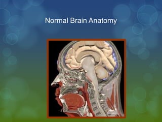 Normal Brain Anatomy
 