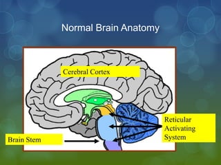 Normal Brain Anatomy



             Cerebral Cortex




                                    Reticular
                                    Activating
Brain Stem                          System
 
