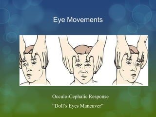 Eye Movements




Occulo-Cephalic Response
“Doll’s Eyes Maneuver”
 