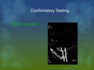 Confirmatory Testing


MR- Angiography
 