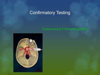 Confirmatory Testing


     Transcranial Ultrasonography
 