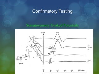 Confirmatory Testing


Somatosensory Evoked Potentials
 