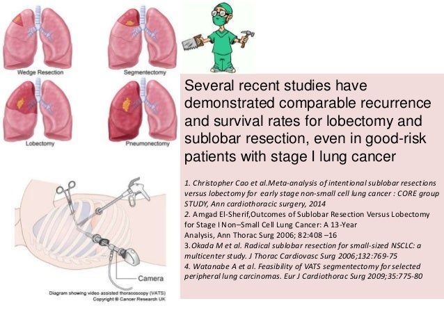 SBRT versus Surgery in Early lung cancer : Debate