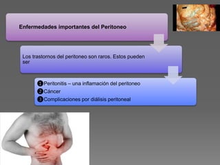 Enfermedades importantes del Peritoneo
Los trastornos del peritoneo son raros. Estos pueden
ser
❶Peritonitis – una inflamación del peritoneo
❷Cáncer
❸Complicaciones por diálisis peritoneal
 