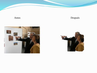 Antes Después
 