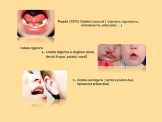 Perelló [(1970): Dislalia funcional ( rotacismo, sigmatismo,
lambdacismo, deltacismo….)
b.- Dislalia audiógena ( sordera poslocutiva,
hipoacusia prelocutiva)
Dislalia orgánica
a.- Dislalia orgánica o disglosia (labial,
dental, lingual, palatal, nasal)
 