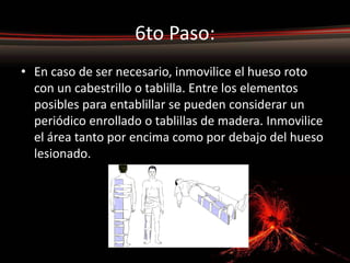 6to Paso:
• En caso de ser necesario, inmovilice el hueso roto
  con un cabestrillo o tablilla. Entre los elementos
  posibles para entablillar se pueden considerar un
  periódico enrollado o tablillas de madera. Inmovilice
  el área tanto por encima como por debajo del hueso
  lesionado.
 