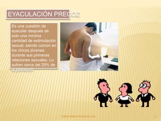 Carlos Alberto Analuiza Lara. 11
Es una cuestión de
eyacular después de
solo una mínima
cantidad de estimulación
sexual, siendo común en
los chicos jóvenes
durante sus primeras
relaciones sexuales. Lo
sufren cerca del 29% de
la población.
EYACULACIÓN PRECOZ
 
