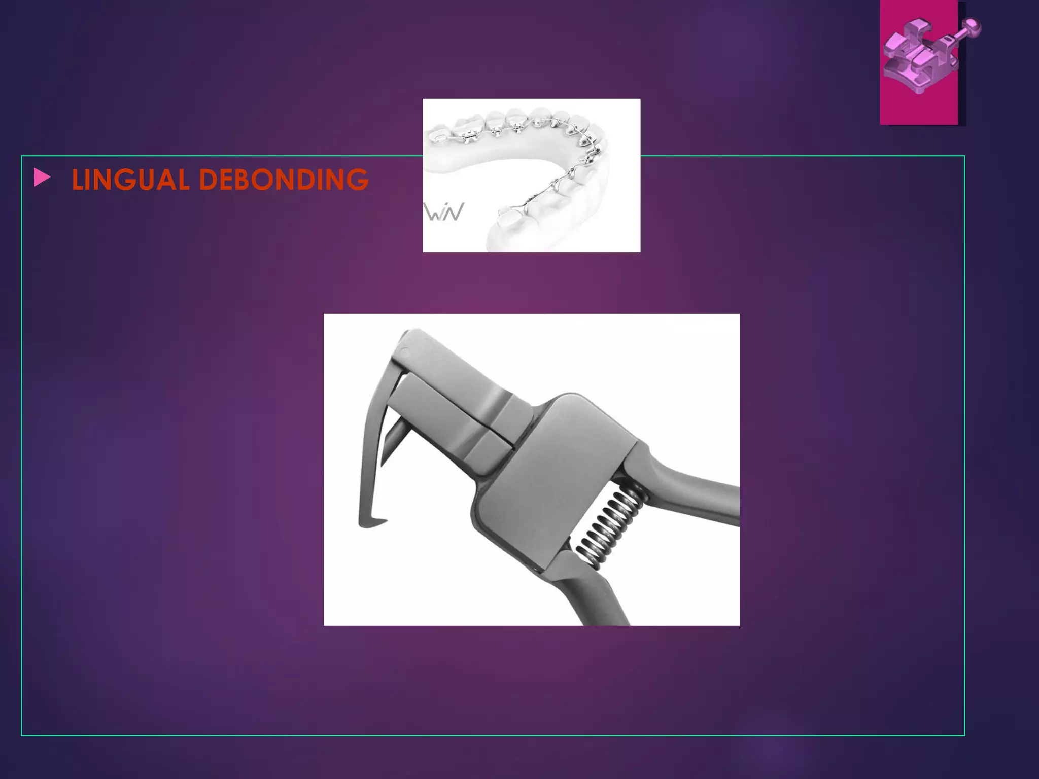  LINGUAL DEBONDING
 