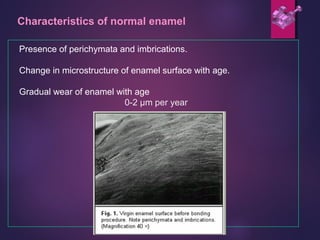Presence of perichymata and imbrications.
Change in microstructure of enamel surface with age.
Gradual wear of enamel with age
0-2 µm per year
Characteristics of normal enamel
 
