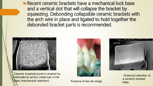 Clarity Advanced Ceramic Brackets 3m Unitek Orthodontic Solutions 3m Europe Orthodontics Advanced Ceramics Orthodontics Braces