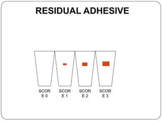 RESIDUAL ADHESIVE

SCOR
E0

SCOR
E1

SCOR
E2

SCOR
E3

 