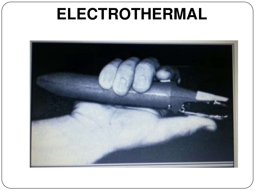 Debonding procedures in orthodontics