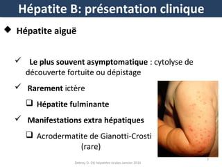 Hépatite B: présentation clinique
 Hépatite aiguë
 Le plus souvent asymptomatique : cytolyse de
découverte fortuite ou dépistage
 Rarement ictère
 Hépatite fulminante
 Manifestations extra hépatiques
 Acrodermatite de Gianotti-Crosti
(rare)
Debray D- DU hépatites virales-Janvier 2014

7

 