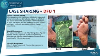 Dfu Management Debridement Consensus against clean - PPT.pptx