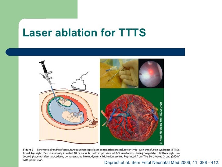 Anaesthesia for foetal surgery