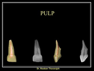 PULP
Dr. Rooban Thavarajah