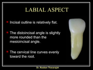 LABIAL ASPECT
Incisal outline is relatively flat.
The distoincisal angle is slightly
more rounded than the
mesioincisal angle.
The cervical line curves evenly
toward the root.
Dr. Rooban Thavarajah