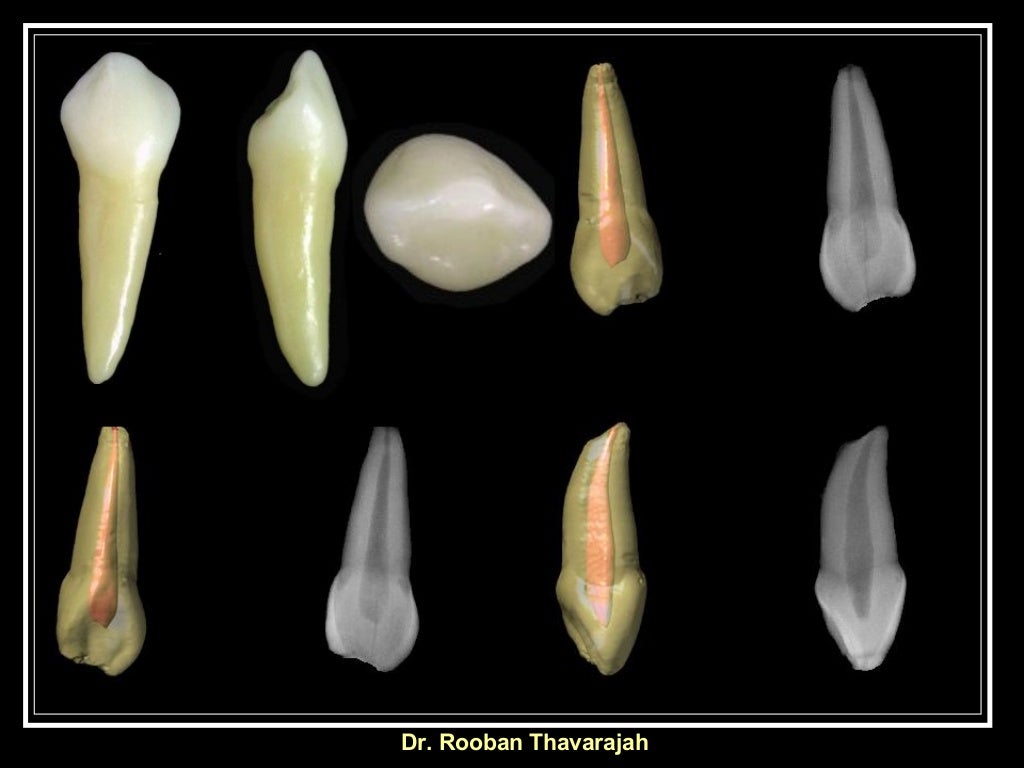 Morphology of Human Deciduous Maxillary Canine Tooth