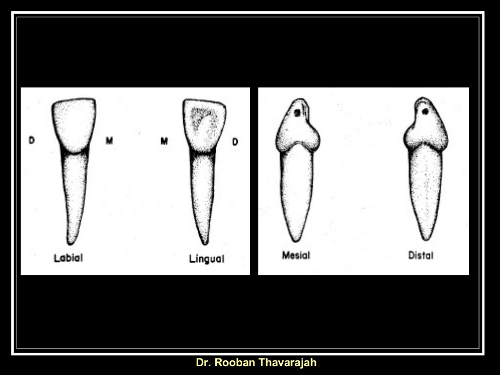Morphology Of Human Deciduous Mandibular Central Incisor Tooth