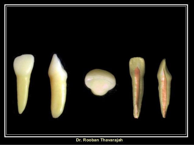incisor mandibular lateral deciduous morphology longitudinal curvature