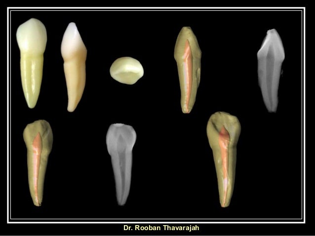 Morphology of Human Deciduous Mandibular Canine Tooth