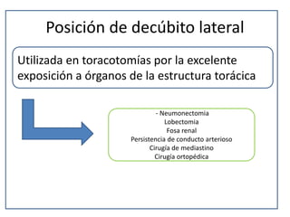 Posición de decúbito lateral
Utilizada en toracotomías por la excelente
exposición a órganos de la estructura torácica
- Neumonectomia
Lobectomia
Fosa renal
Persistencia de conducto arterioso
Cirugía de mediastino
Cirugía ortopédica
 