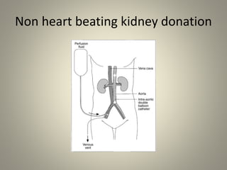 Non heart beating kidney donation
 