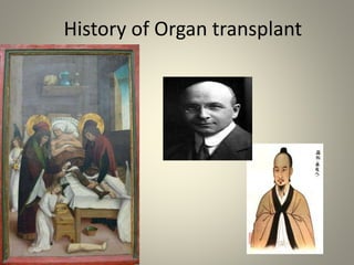 History of Organ transplant
 