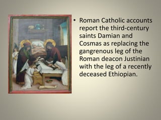 • Roman Catholic accounts
report the third-century
saints Damian and
Cosmas as replacing the
gangrenous leg of the
Roman deacon Justinian
with the leg of a recently
deceased Ethiopian.
 