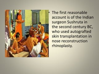 • The first reasonable
account is of the Indian
surgeon Sushruta in
the second century BC,
who used autografted
skin transplantation in
nose reconstruction
rhinoplasty.
 