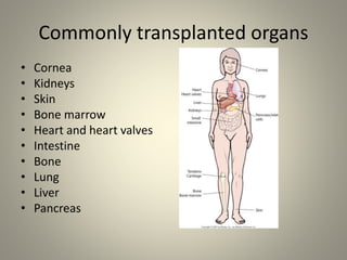 Commonly transplanted organs
• Cornea
• Kidneys
• Skin
• Bone marrow
• Heart and heart valves
• Intestine
• Bone
• Lung
• Liver
• Pancreas
 