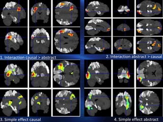 1. Interaction causal > abstract   2. Interaction abstract > causal




3. Simple effect causal                4. Simple effect abstract
 