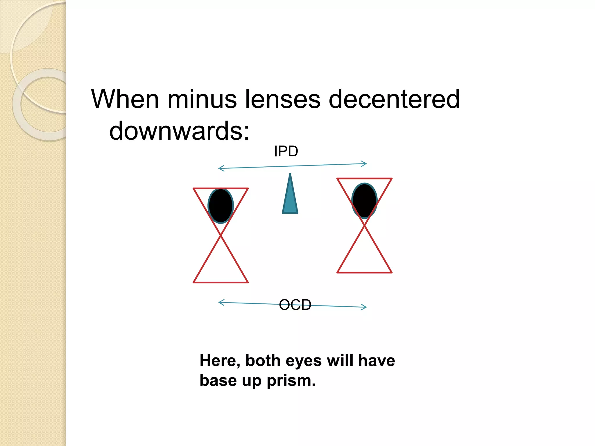 When minus lenses decentered
downwards:
IPD
OCD
Here, both eyes will have
base up prism.
 
